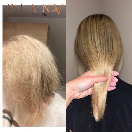HaarBotox Therapie PreNano Herstel- en Diepvoedende Haarbehandeling 1000ml